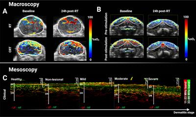 The Potential of Photoacoustic Imaging in Radiation Oncology